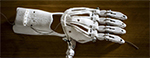 La prothèse de main 3D à petit prix